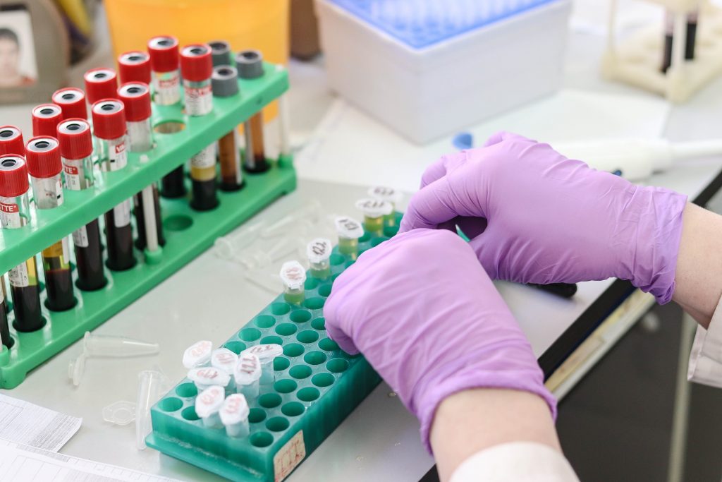 A medical technologist doing a blood test