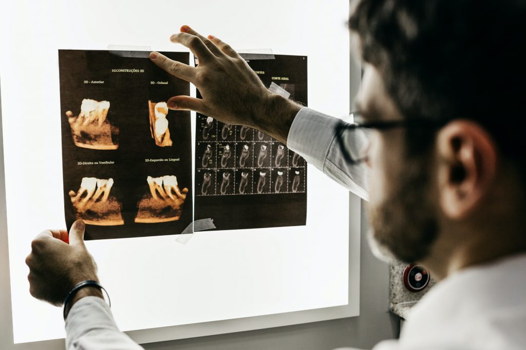 An x-ray technician is looking at the x-ray result of a patient