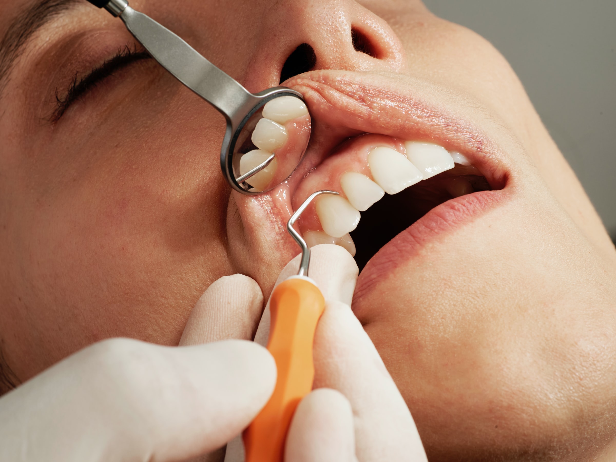 14 Pros and Cons of Being a Dental Hygienist