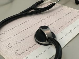 EKG