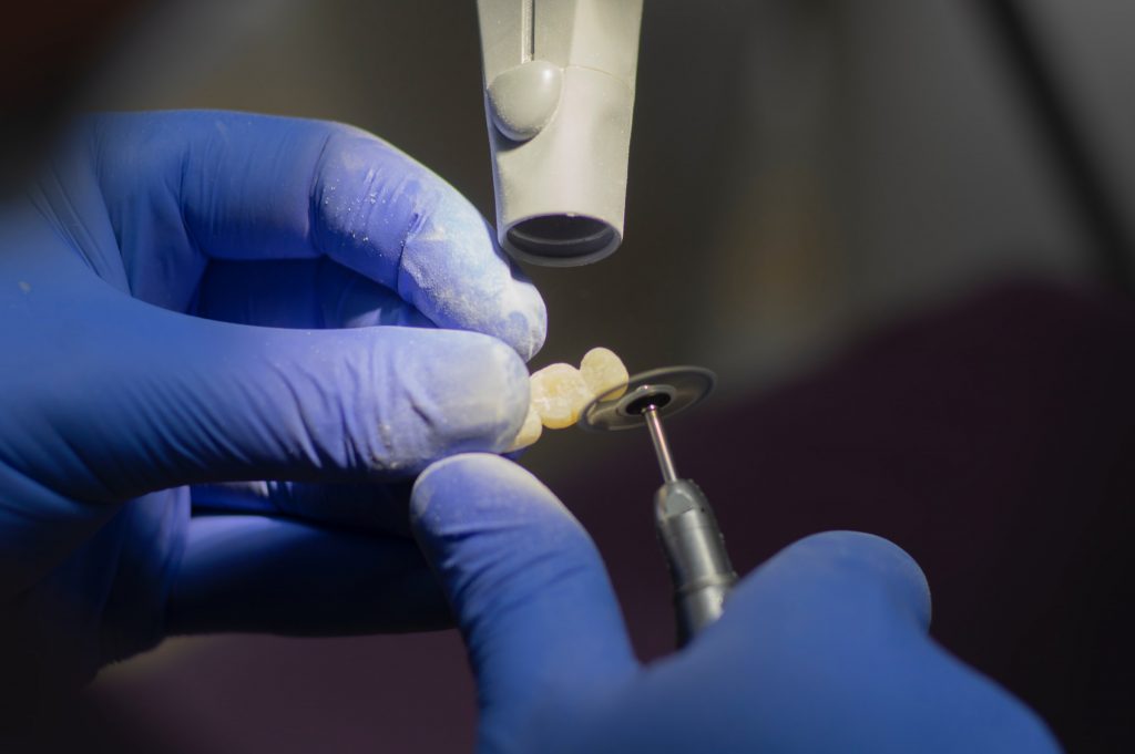 dentist doing temporary crown on teeth